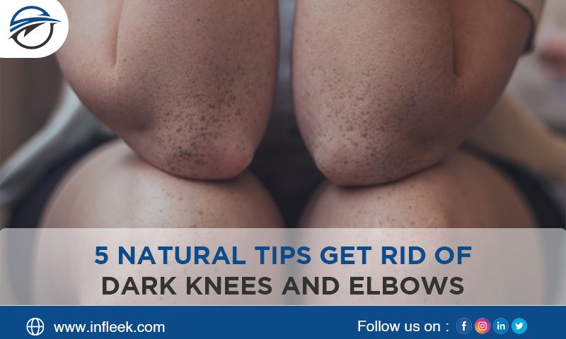 natural tips get rid of dark knees